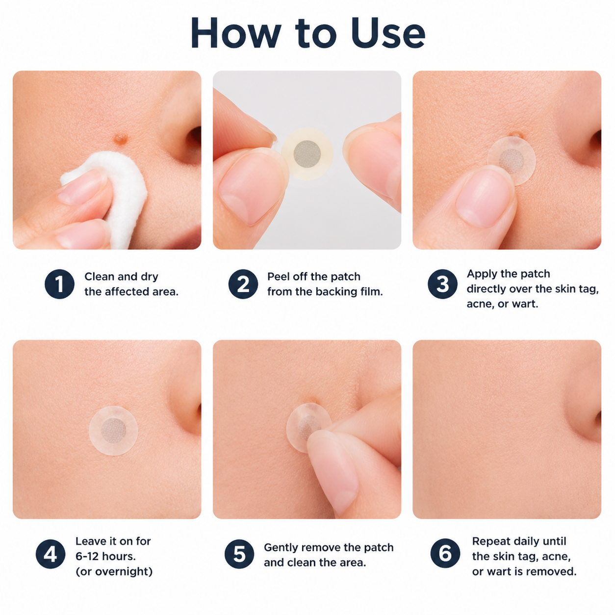 ✨2-in-1 Microneedle & Hydrocolloid Patch🍀| Removes Raised Moles, Acne, Flat Warts & Skin Tags | Helps Improve Wrinkles, Scars & Blemishes | Invisible Patches for Face & Body