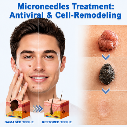 ✨2-in-1 Microneedle & Hydrocolloid Patch🍀| Removes Raised Moles, Acne, Flat Warts & Skin Tags | Helps Improve Wrinkles, Scars & Blemishes | Invisible Patches for Face & Body