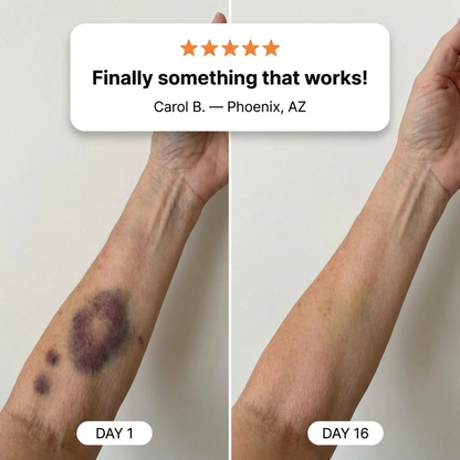 Neravio® Bruise Repair & Skin-Strengthening Cream