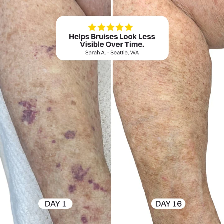 Neravio® Bruise Repair & Skin-Strengthening Cream