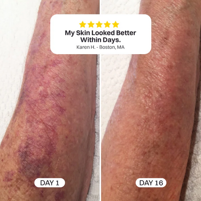 Neravio® Bruise Repair & Skin-Strengthening Cream