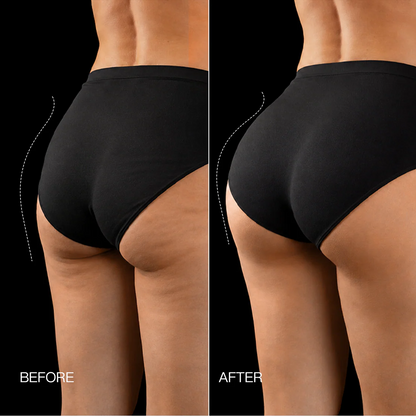 Neravio 3-Zone EMS Toning Shorts: Targeted Abdomen, Glutes & Pelvic Floor Support