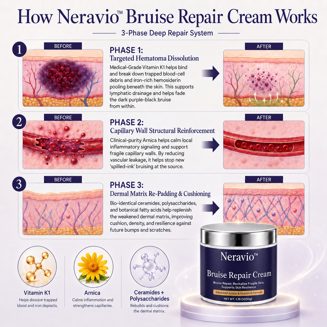 How Neravio™ Bruise Repair Cream works